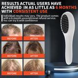 Laser Therapy Hair Growth Comb – Red Light Low-Level Laser Therapy Device for Men & Women