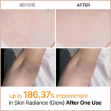 Kojic Acid & Turmeric Exfoliating Body Spray for Brightening, Nourishing & Skin Renewal