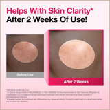 Anua 10% Niacinamide Dark Spot Correcting Serum with Tranexamic Acid & Arbutin for Brightening