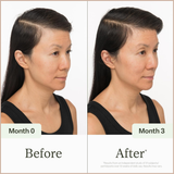 Scalp Health Serum – Hair Density & Fullness Support for Thinning Hair